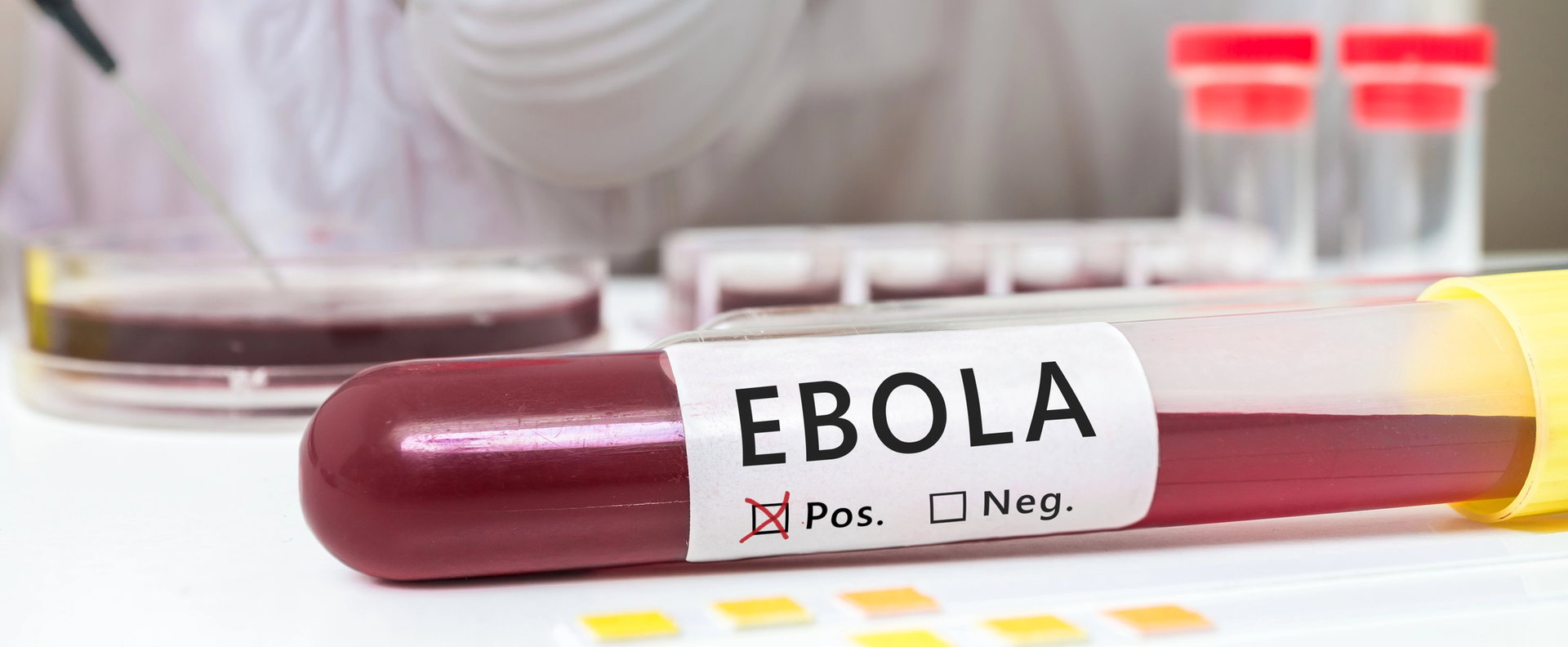 Európában azonosították az Ebola-vírust